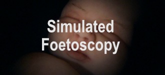 Sim Foetoscopy 2